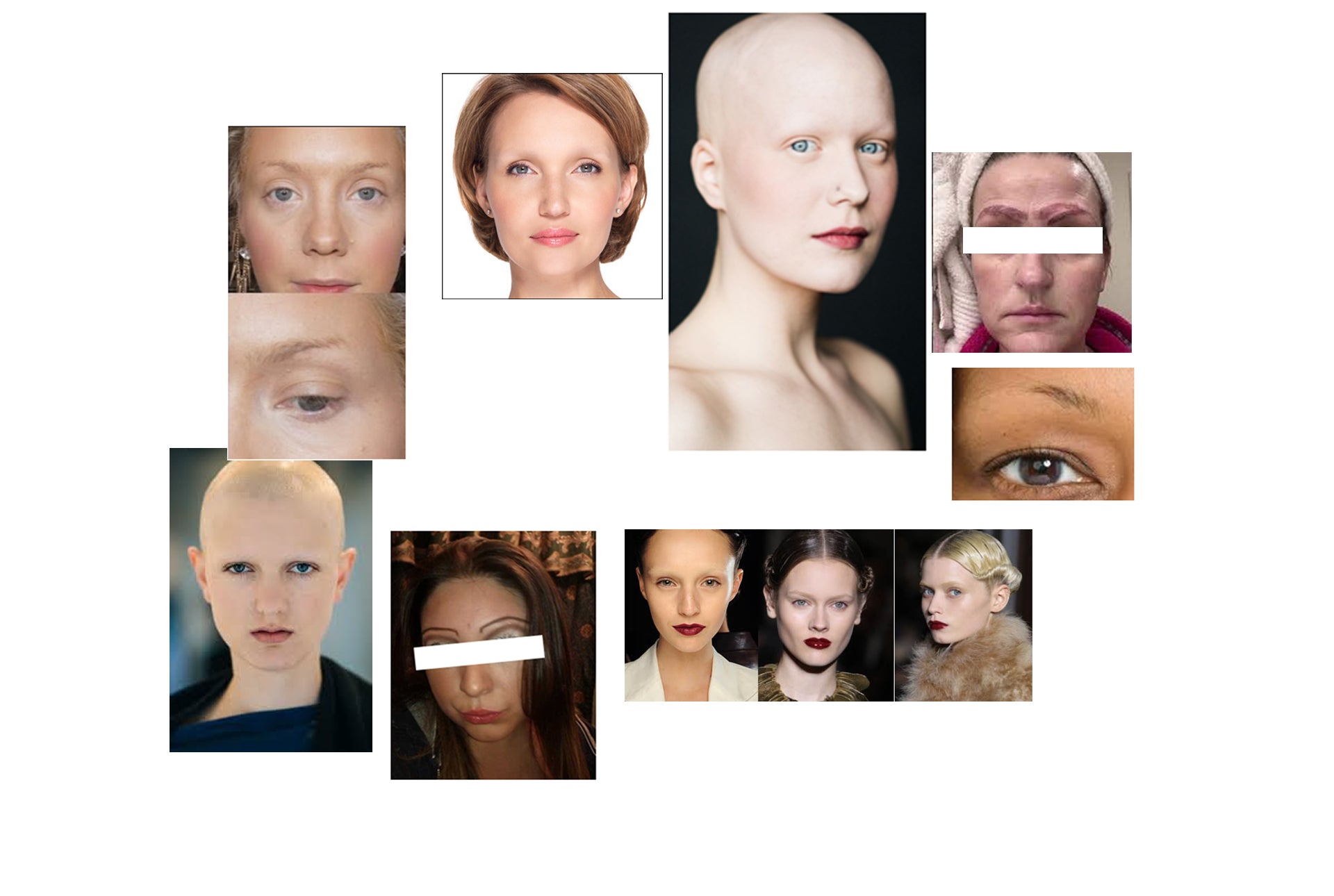 BROW LOSS